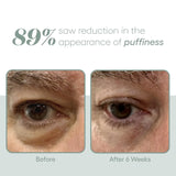 Plated Exosome Eye Serum
