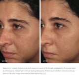 ORMEDIC BALANCING BIOPEPTIDE CRÈME